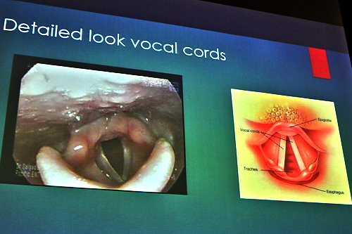 Detailed look at vocal cords